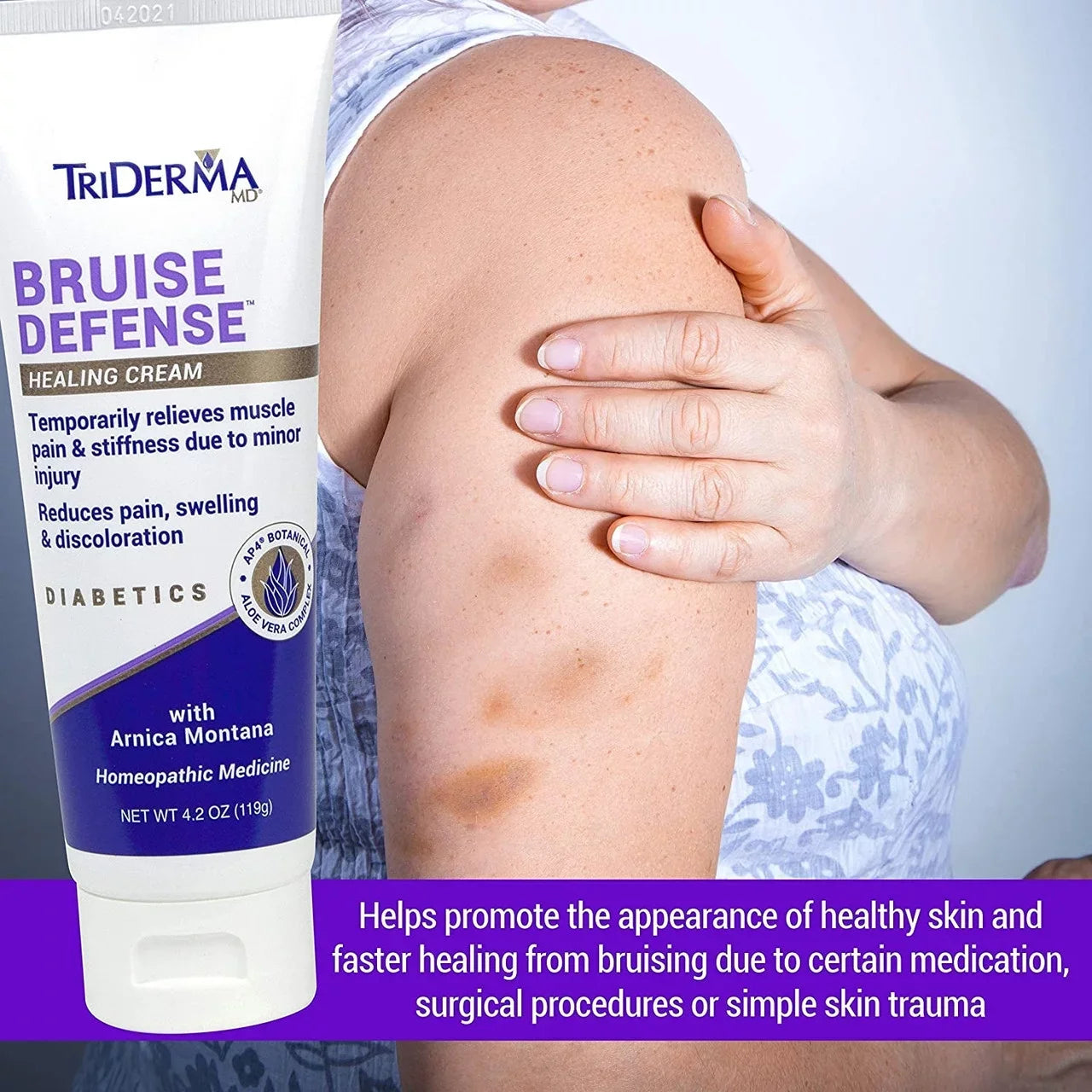 Triderma 2.2 [2 ] oz packs Cream Bruise Healing Defense