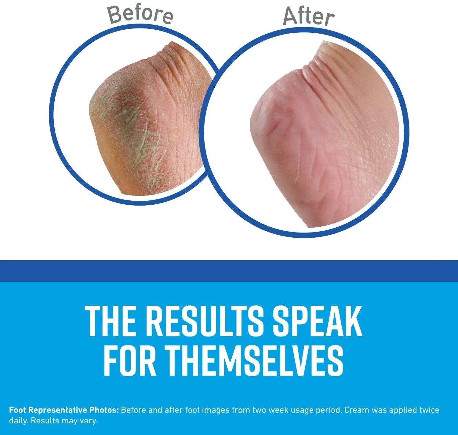PC,O'Keeffee's Tube, 3 Healthy 1 K0280001 Cream Oz Feet